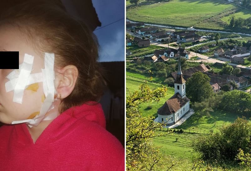 foto copilă din laslea mușcată de față de câinele unui vecin - mama se revoltă: „fetița mea era să moară”