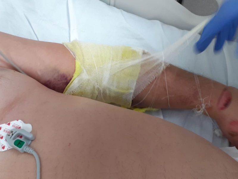 procurorii cercetează dacă pacienții cu covid 19 sunt uciși la secția de ati sibiu