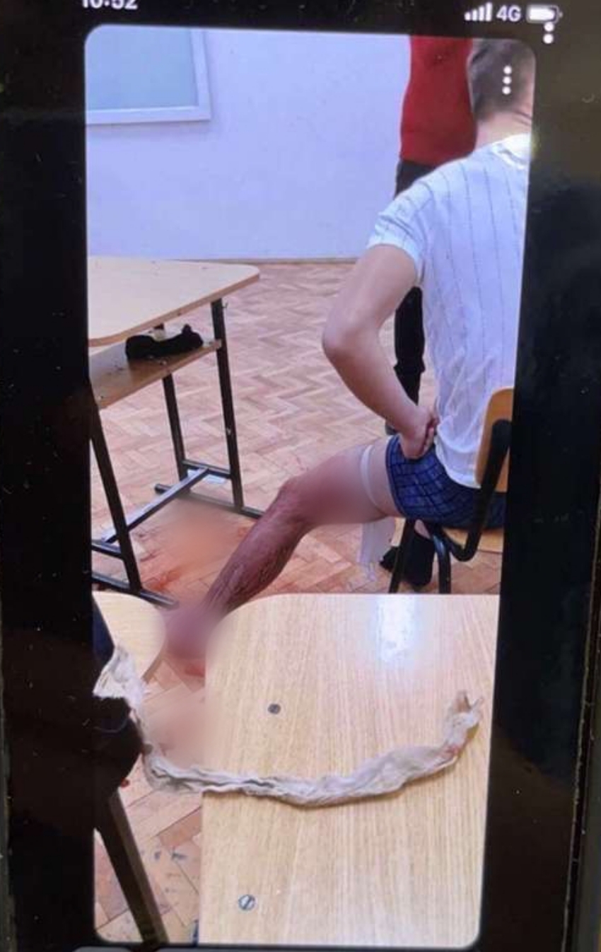 FOTO Băiatul înjunghiat la Colegiul Școala de Gaz - A mințit ca să-și protejeze colegul - Director: „Sunt prieteni și s-au jucat” 3 foto băiatul înjunghiat la colegiul școala de gaz - a mințit ca să-și protejeze colegul - director: „sunt prieteni și s-au jucat”